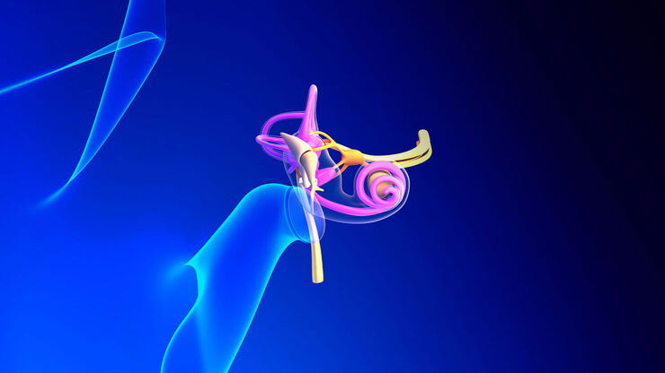 Superior Semicircular Canal Dehiscence (SSCD) or Minor’s syndrome. Superior Semicircular Canal Dehiscence (SSCD) or Minor’s syndrome.