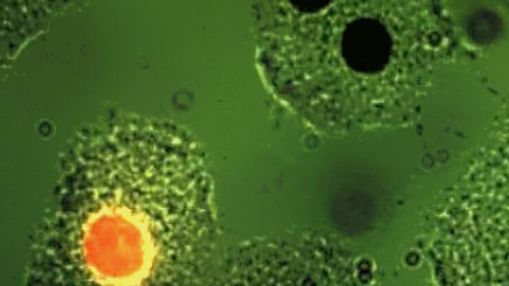 Fluorescence microscopy image of liver tissue where DNA in the nuclei are stained with Feulgen-pararosanilin and visualized with transmitted green light. Fluorescence microscopy image of liver tissue where DNA in the nuclei are stained with Feulgen-pararosanilin and visualized with transmitted green light.
