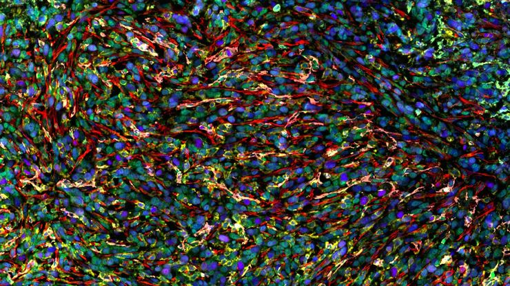 Cell DIVE multiplexed image of FFPE tissue section from syngeneic murine cancer model, 4T1. Cell DIVE multiplexed image of FFPE tissue section from syngeneic murine cancer model, 4T1.
