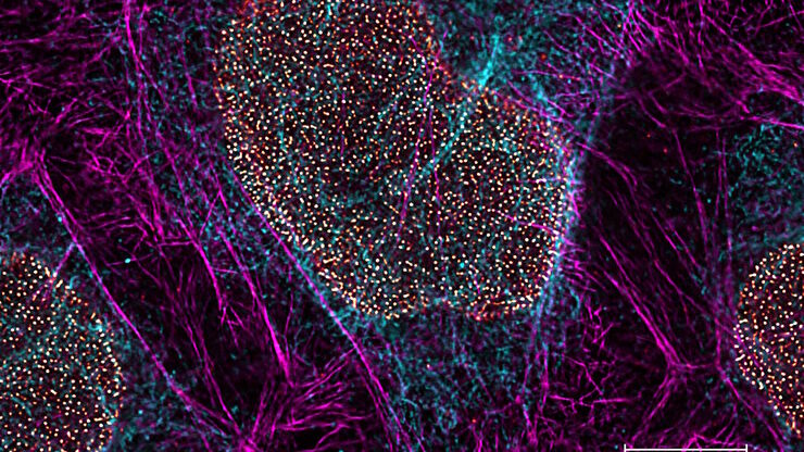 Multicolor TauSTED Xtend 775 for Cell Biology applications that require nanoscopy resolution for multiple cellular components. Cells showing vimentin fibrils (AF 594), actin network (ATTO 647N), and nuclear pore basket (CF 680R). Multicolor TauSTED Xtend 775 for Cell Biology applications that require nanoscopy resolution for multiple cellular components. Cells showing vimentin fibrils (AF 594), actin network (ATTO 647N), and nuclear pore basket (CF 680R). Sample courtesy of Brigitte Bergner, Mariano Gonzales Pisfil, Steffen Dietzel, Core Facility Bioimaging, Biomedical Center, Ludwig-Maximilians-University, Munich, Germany.