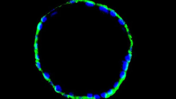 小鼠子宫内膜类器官的免疫荧光图像(CK14 和 DAPI 染色) 小鼠子宫内膜类器官的免疫荧光图像(CK14 和 DAPI 染色)