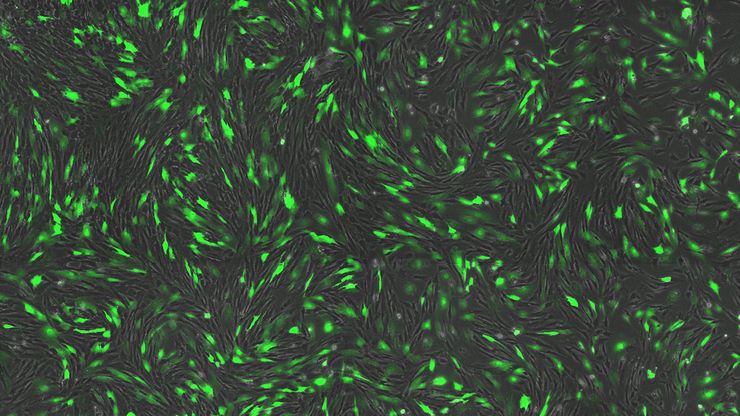 Transfection using the Uncommon Bio reprogramming system. Image acquired using the THUNDER Imager 3D Cell Culture with THUNDER Large Volume Computational Clearing (LVCC) applied. Image courtesy of Samuel East, Uncommon Bio. Transfection using the Uncommon Bio reprogramming system. Image acquired using the THUNDER Imager 3D Cell Culture with THUNDER Large Volume Computational Clearing (LVCC) applied. Image courtesy of Samuel East, Uncommon Bio.